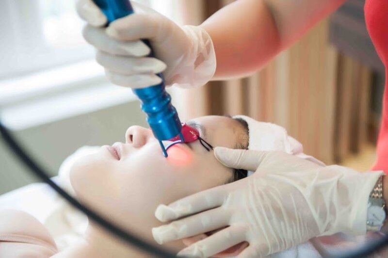 Quá trình chăm sóc da sau laser chính là tình trạng tăng sắc tố da sau viêm