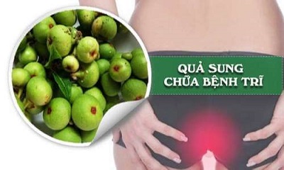 Dùng quả sung chữa bệnh trĩ là phương pháp được nhiều người áp dụng