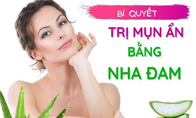 Cách trị mụn ẩn bằng nha đam an toàn