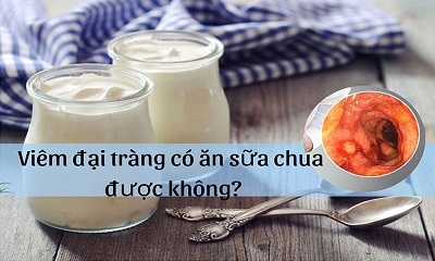 Viêm đại tràng có nên ăn sữa chua?