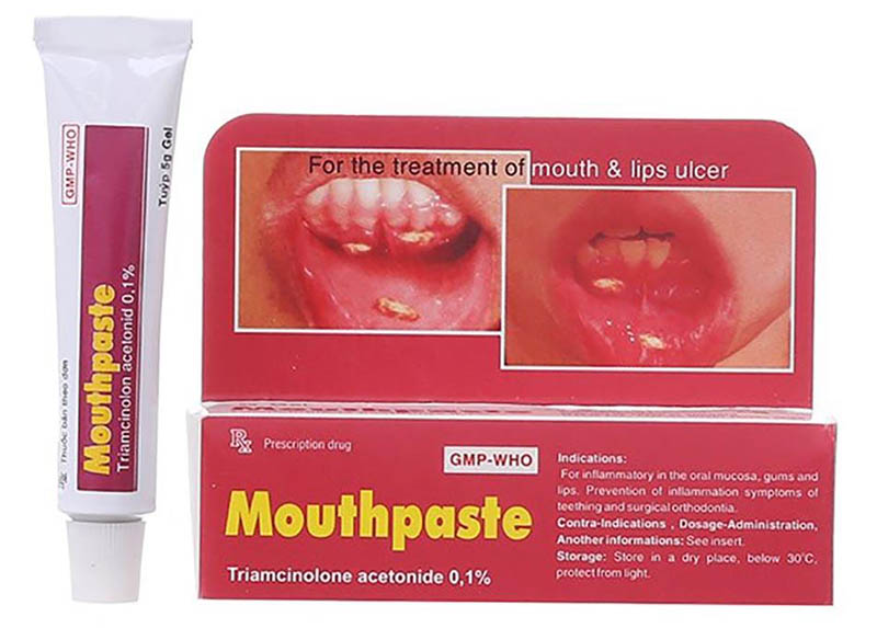 Mouthpaste thuốc bôi trị nhiệt miệng 