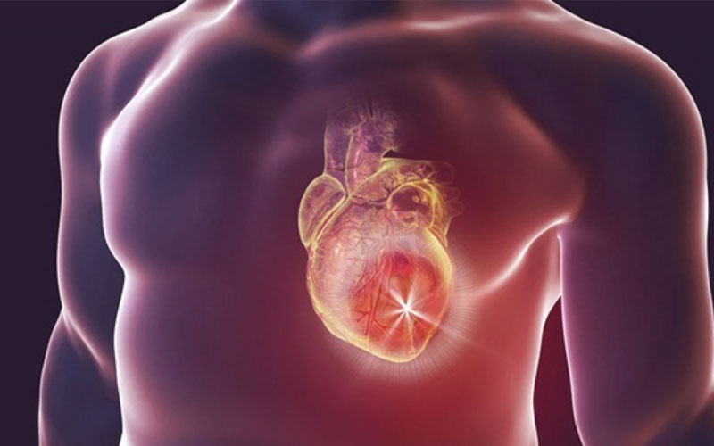 Các đối tượng mắc bệnh suy tim sung huyết đều có nguy cơ phải đối diện với tình trạng hụt hơi