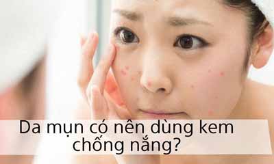 Da Mụn Có Nên Dùng Kem Chống Nắng