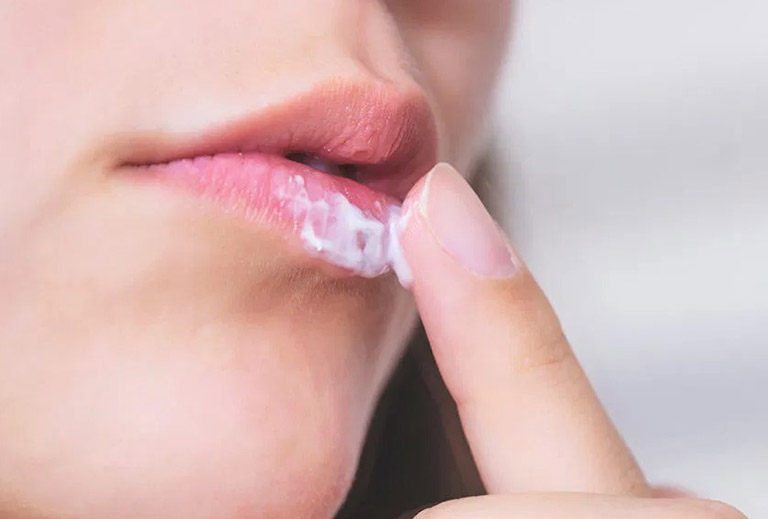 Kem bôi Goudron sau khi thoa lên môi sẽ làm dịu nhanh chóng triệu chứng của bệnh chàm môi