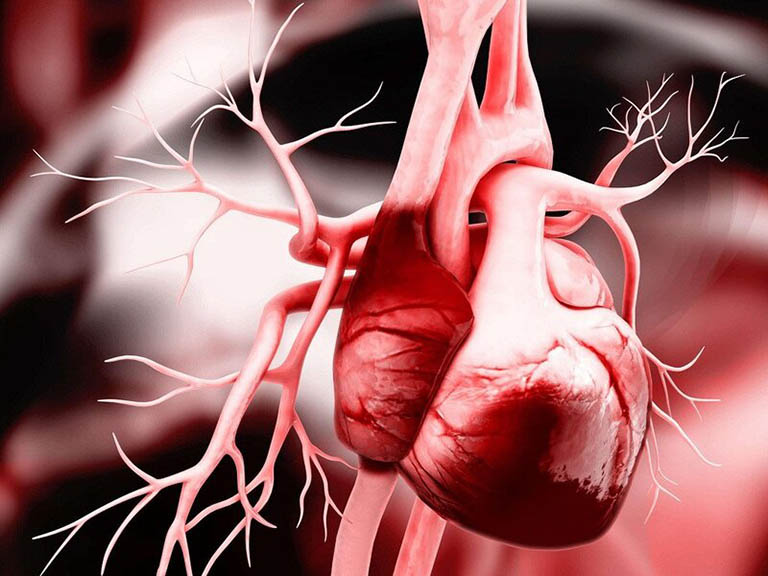 Suy tim khiến chức năng tim bị suy giảm và ảnh hưởng nghiêm trọng đến sức khỏe