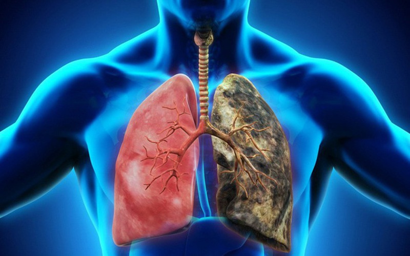 Đối tượng đang gặp các bệnh về phổi nên dùng trùng thảo dạng sợi thường xuyên