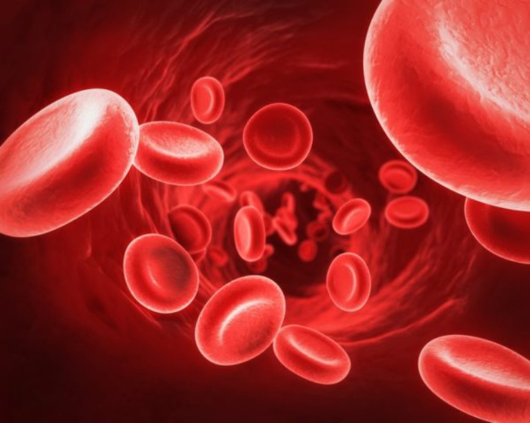 Bổ sung sắt giúp tăng sinh hồng cầu và đẩy lùi chứng thiếu máu