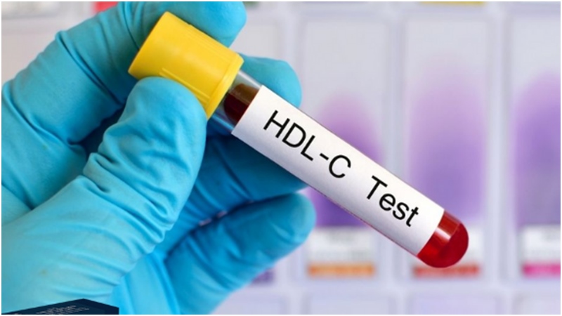 Có thể xét nghiệm máu để test chỉ số HDL