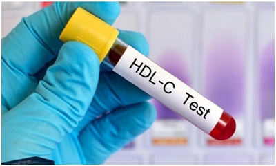 Chỉ Số HDL Cholesterol Có Ý Nghĩa Gì, Tăng Hay Giảm Là Tốt?