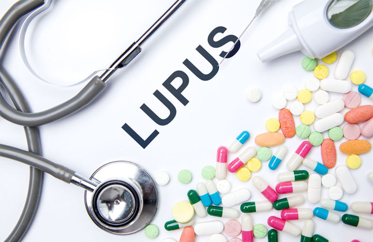 Thuốc điều trị Lupus ban đỏ