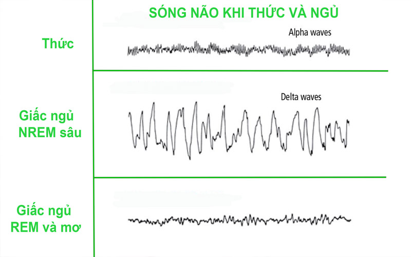 Sóng não ở các chu kỳ giấc ngủ