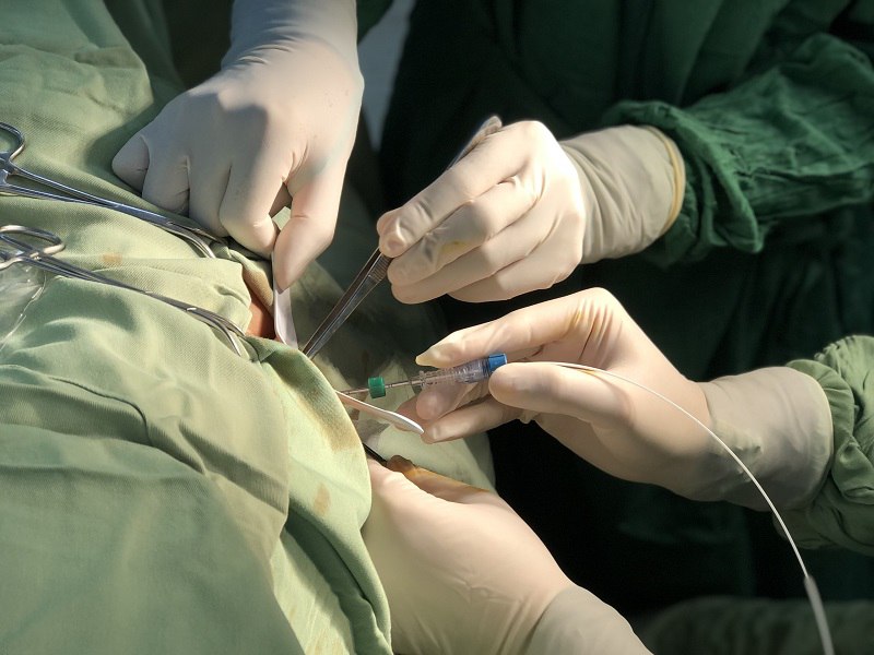 Phẫu thuật cắt búi trĩ được áp dụng khi việc dùng thuốc không mang lại hiệu quả